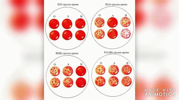 Почему 4 группа крови универсальный реципиент