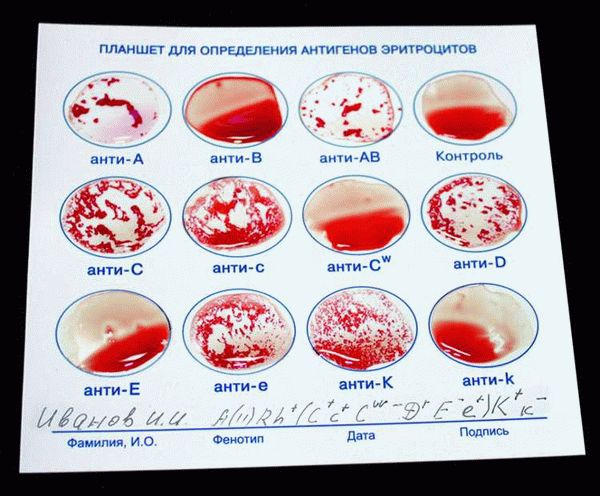 Совместимость групп крови при переливании