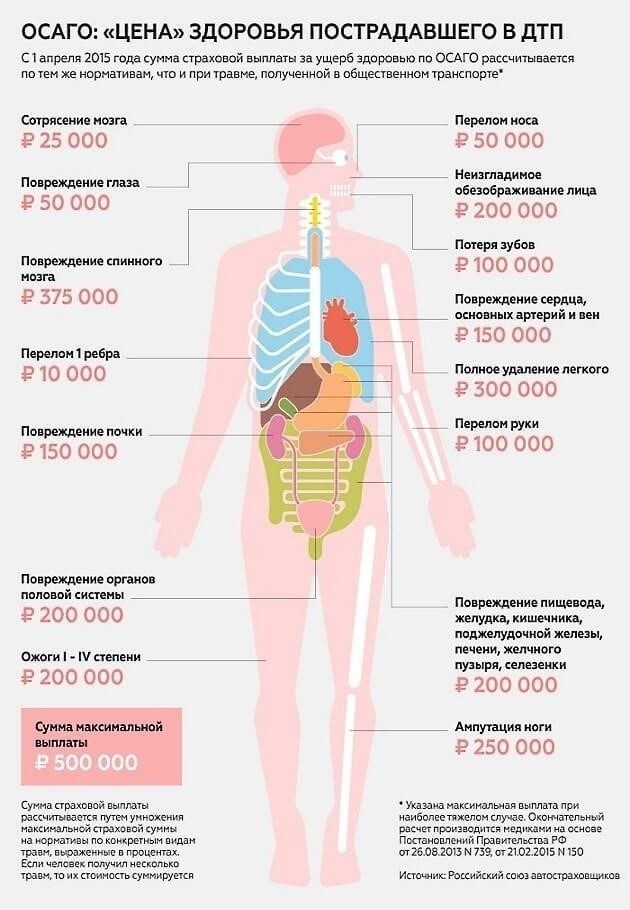 Определение размера компенсации за травму по ОСАГО